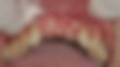 二、深圳正恩口腔(羅湖總店)医生团队，打造专精诊疗服务