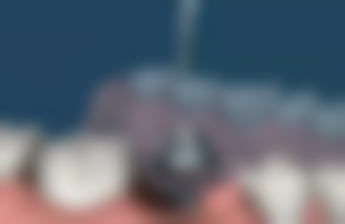 七、博宁口腔门诊部（杏林店）就医指南，便捷就诊不迷路