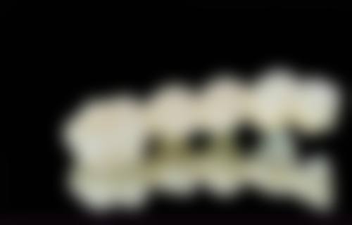 四、浙江嘉嘉善徐美芳口腔设备介绍