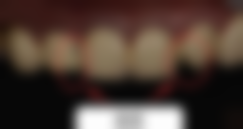 三、恩施咿呀口腔(东方城店)核心科室与特色项目