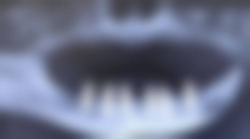 四、安徽芜湖东门口腔设备介绍