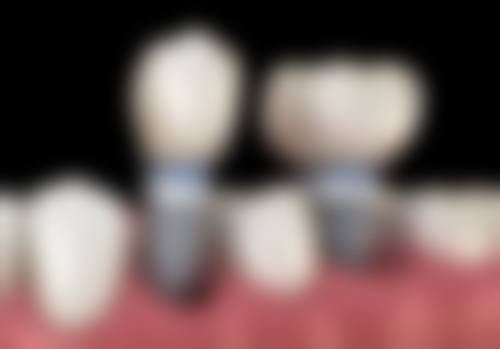 四、恩施咿呀口腔(东方城店)设备介绍