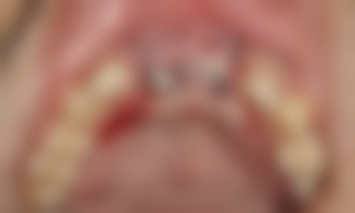 二、山东威海李莉口腔医生团队，打造专精诊疗服务