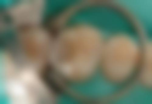 四、中山斯迈口腔设备介绍