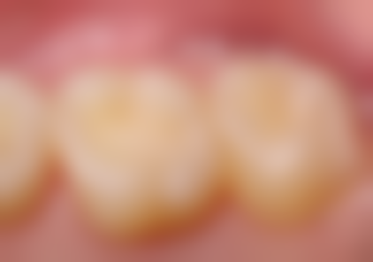 三、深圳兴鸿口腔诊所核心科室与特色项目