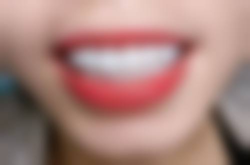 四、韶关壹心口腔诊所设备介绍