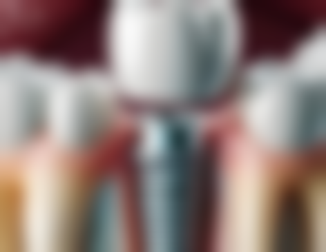 二、江苏泰州靖江宋启忠口腔医生团队，打造专精诊疗服务