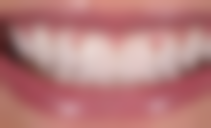 四、湖州吴兴陈景康口腔门诊设备介绍