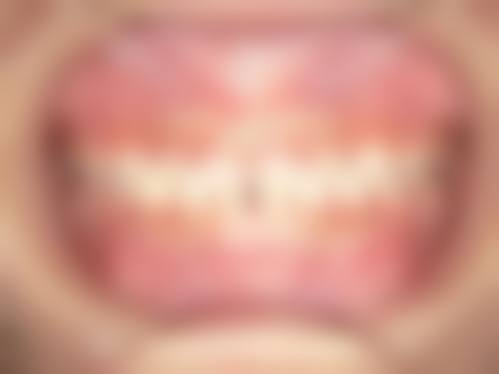 四、庐江县人民医院口腔科设备介绍