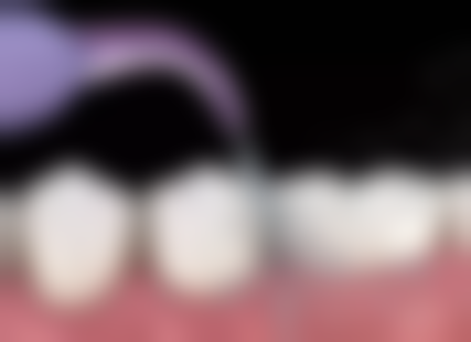 四、四川雅安优诺口腔门诊部设备介绍