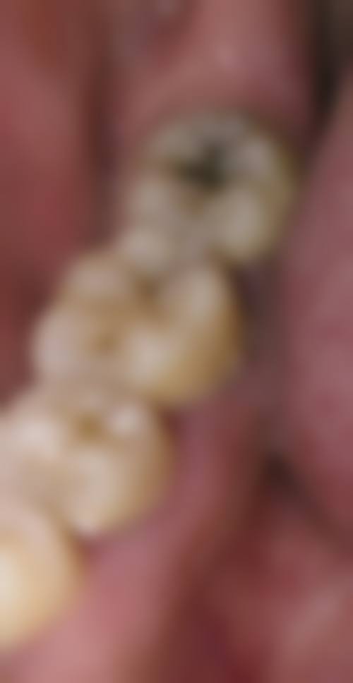 四、陕西商洛丹凤县精诚口腔设备介绍