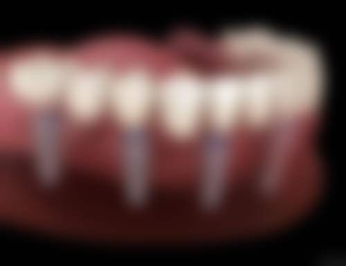 六、汕头佳乐口腔门诊部荣誉资质与患者口碑，见证品牌实力