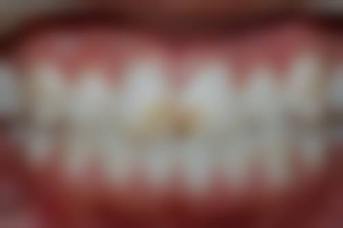 四、济南御山首府医院设备介绍