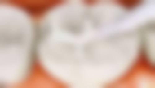 四、深圳纤韵口腔设备介绍