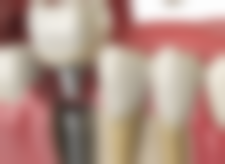 七、深圳永恩口腔门诊就医指南，便捷就诊不迷路