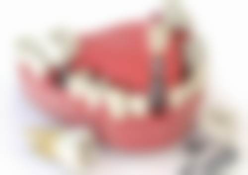 四、濮阳市县正植口腔门诊部设备介绍