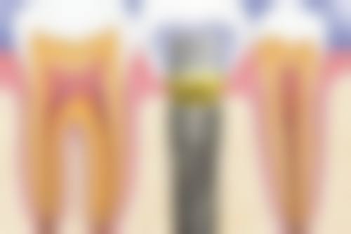 三、东莞茶山阿杰口腔门诊核心科室与特色项目