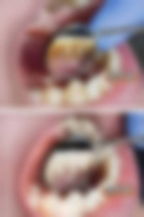 七、陕西宝鸡眉县微笑口腔就医指南,便捷就诊不迷路