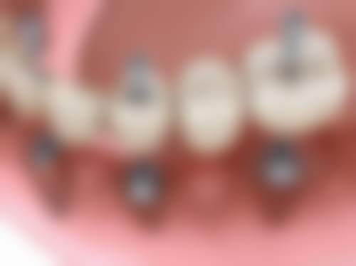 四、湖南怀化三里门诊口腔科设备介绍