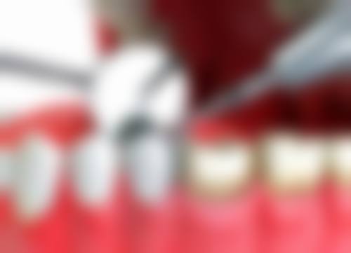 四、南阳牙匠口腔诊所设备介绍