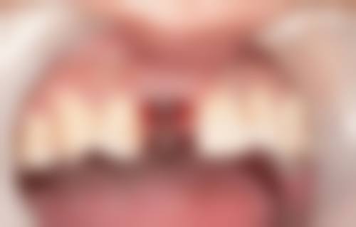 五、达州市李宜洪口腔诊所(通川区)舒适就医环境，打造人性化诊疗体验