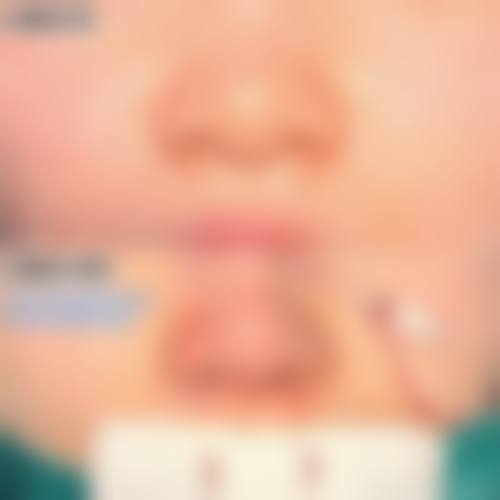 擅长项目详解:广州氧颜医疗美容诊所廖培姣