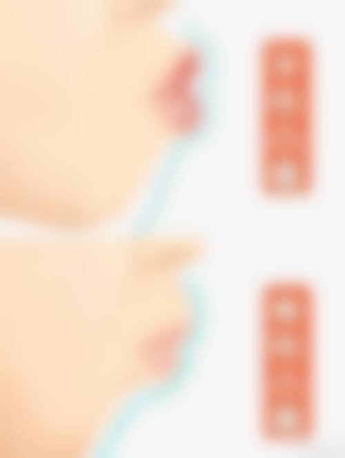 高端设备与环境：欧式VIP服务提升就医体验