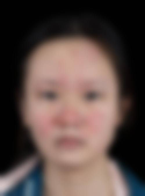 擅长项目详解