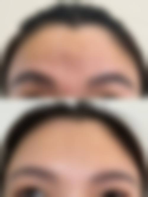 擅长项目详解:广州氧颜医疗美容诊所费滕擅长什么?