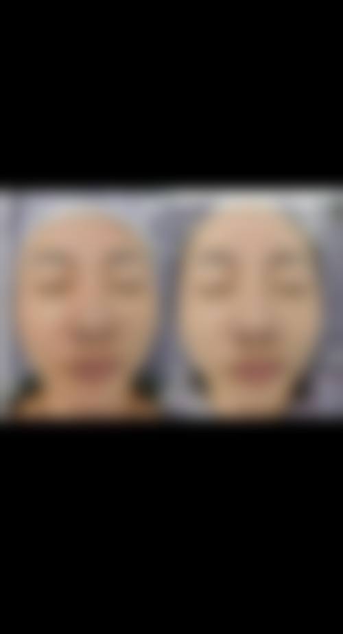 患者真实评价:广州氧颜医疗美容诊所费滕口碑怎样?