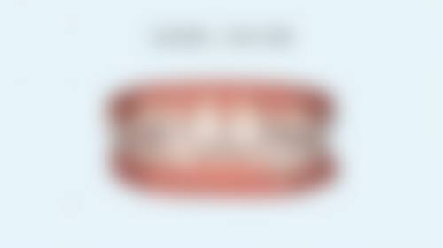 牙齿矫正的优缺点分析