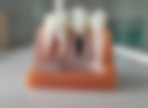 临床实例分享：毕节市惠诚口腔(七星关区)陈明贵