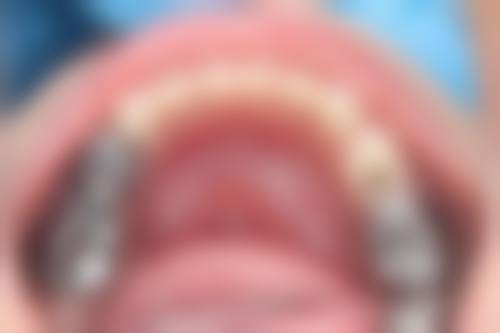 结语