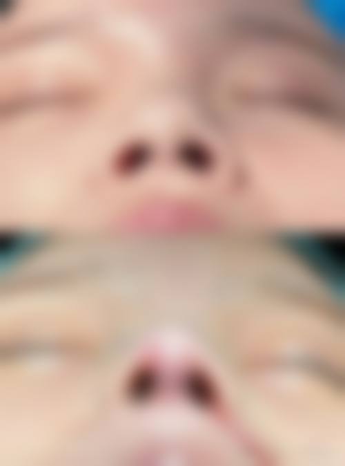 临床实例分享
