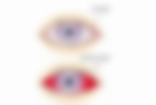 FAQ:关于锦州市中 心医院眼科张先平的常见疑问