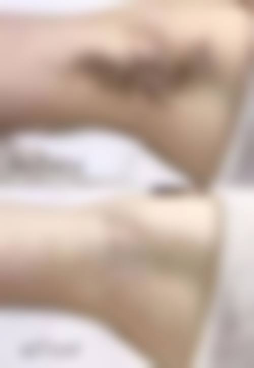擅长项目详解:精细治疗各类皮肤难题