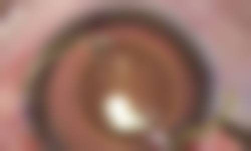 诊疗特色总结:锦州市中 心医院眼科张先平的医疗理念