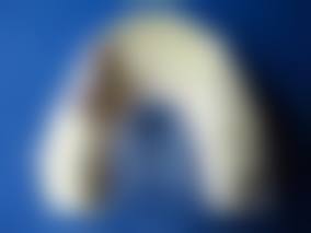 临床实例分享