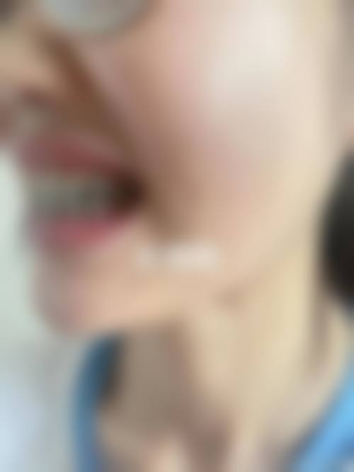 结尾预约号召:立即行动,重拾自信笑容