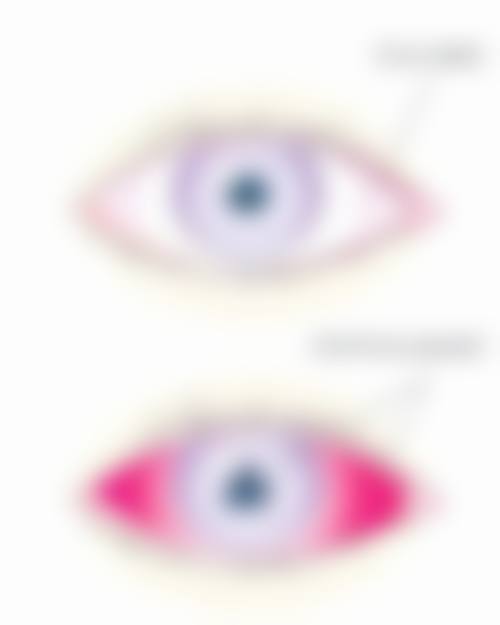 结尾预约号召：立即行动守护视力