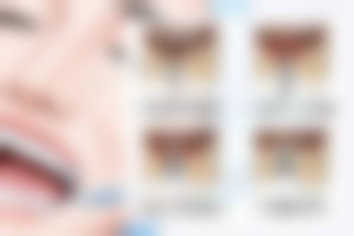 临床实例分享:真实疗效见证专精实力