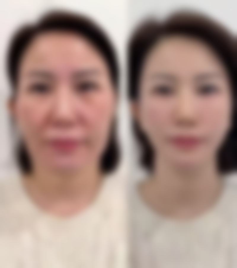 精良设备与安心服务保护