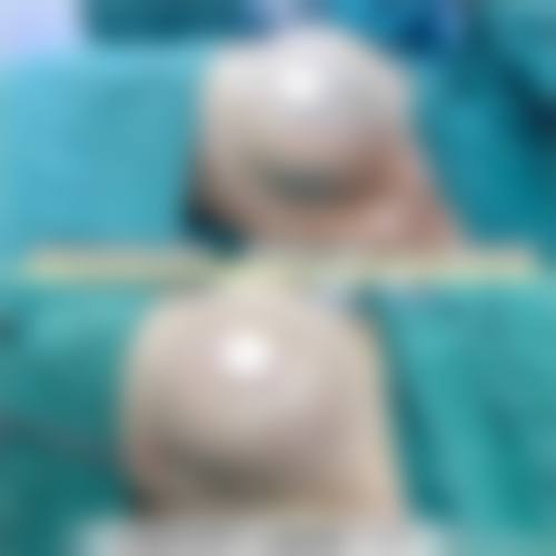 预约优惠活动:现在预约有什么优惠吗?