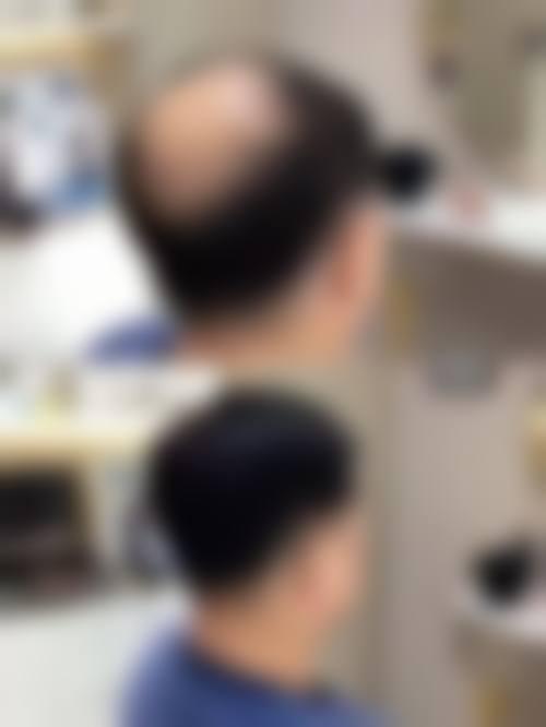 结语：选择金华康美，开启自信美丽人生