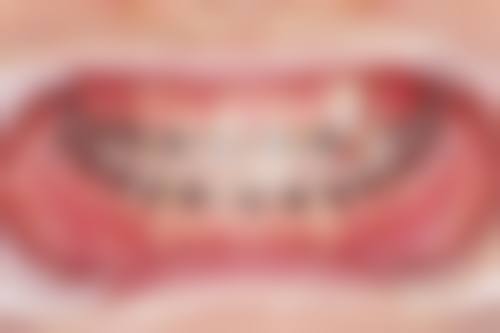 患者真实评价：宁波鄞州德中口腔门诊部刘洪杰