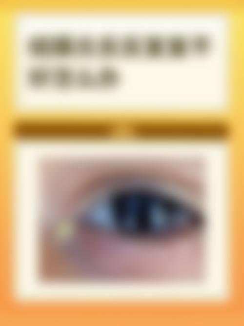 临床实例分享