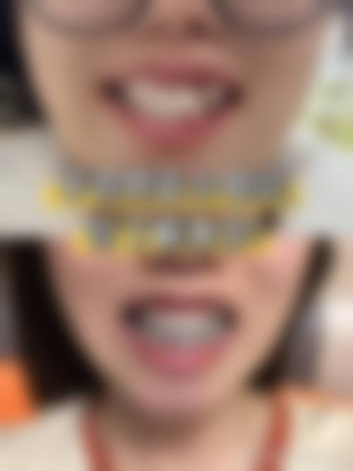 服务体验与人文关怀：超越期待的就医感受