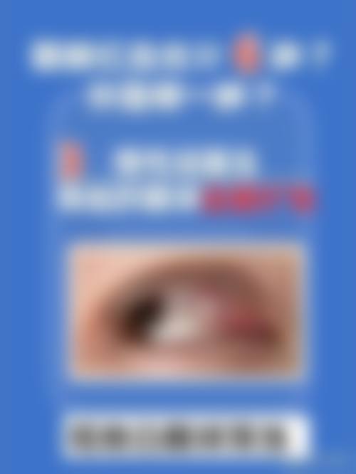 预约优惠活动