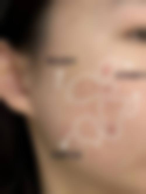 临床实例分享