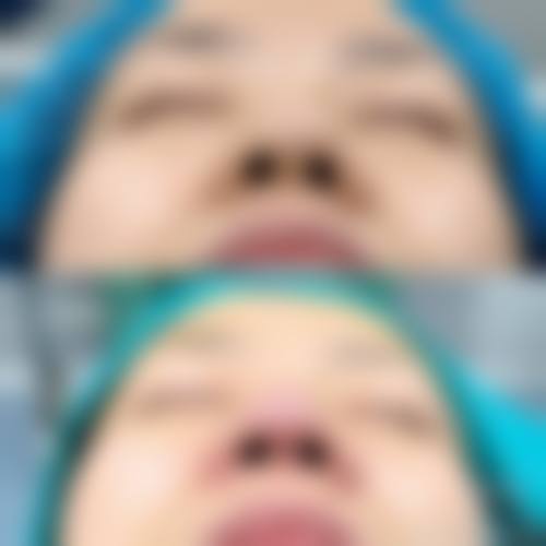 擅长项目详解